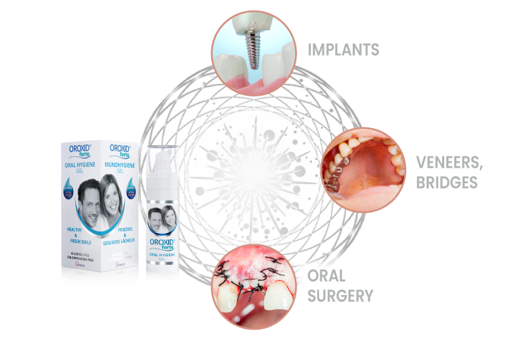 OROXID® Forte Oral Gel 30 ml